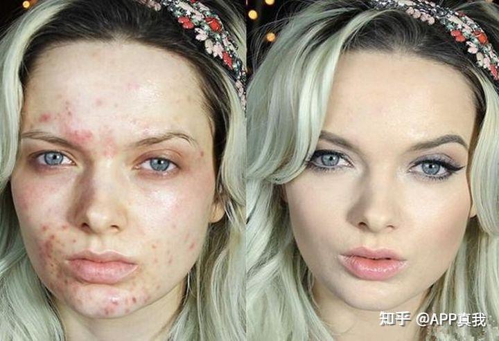 皮肤的好坏对颜值的改变有多大? - 知乎