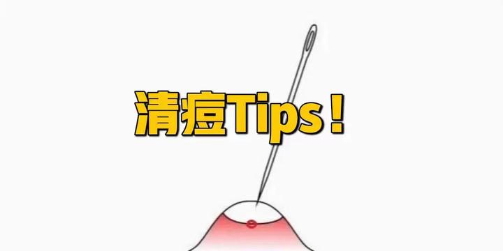 痘痘到底该不该针清？ - 知乎