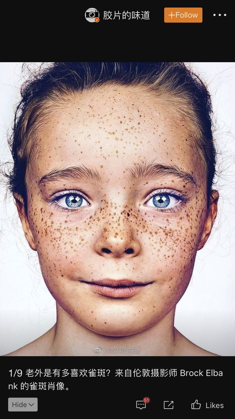 怎么看待脸上有雀斑的女孩子? - 知乎