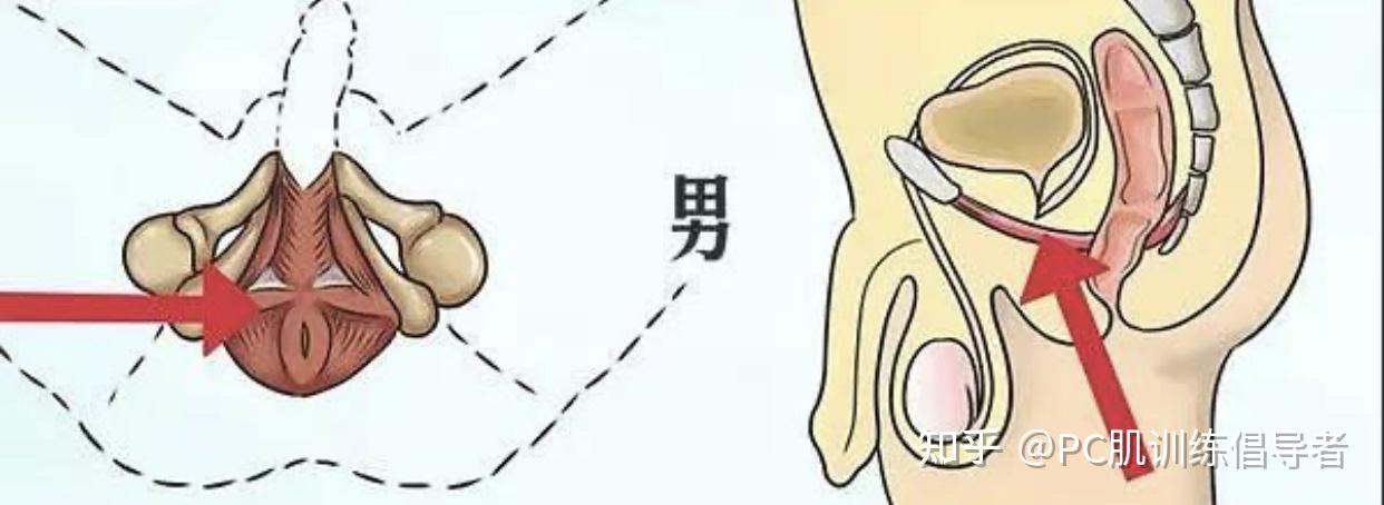 锻炼pc肌可以降低阴茎和龟头的敏感度么