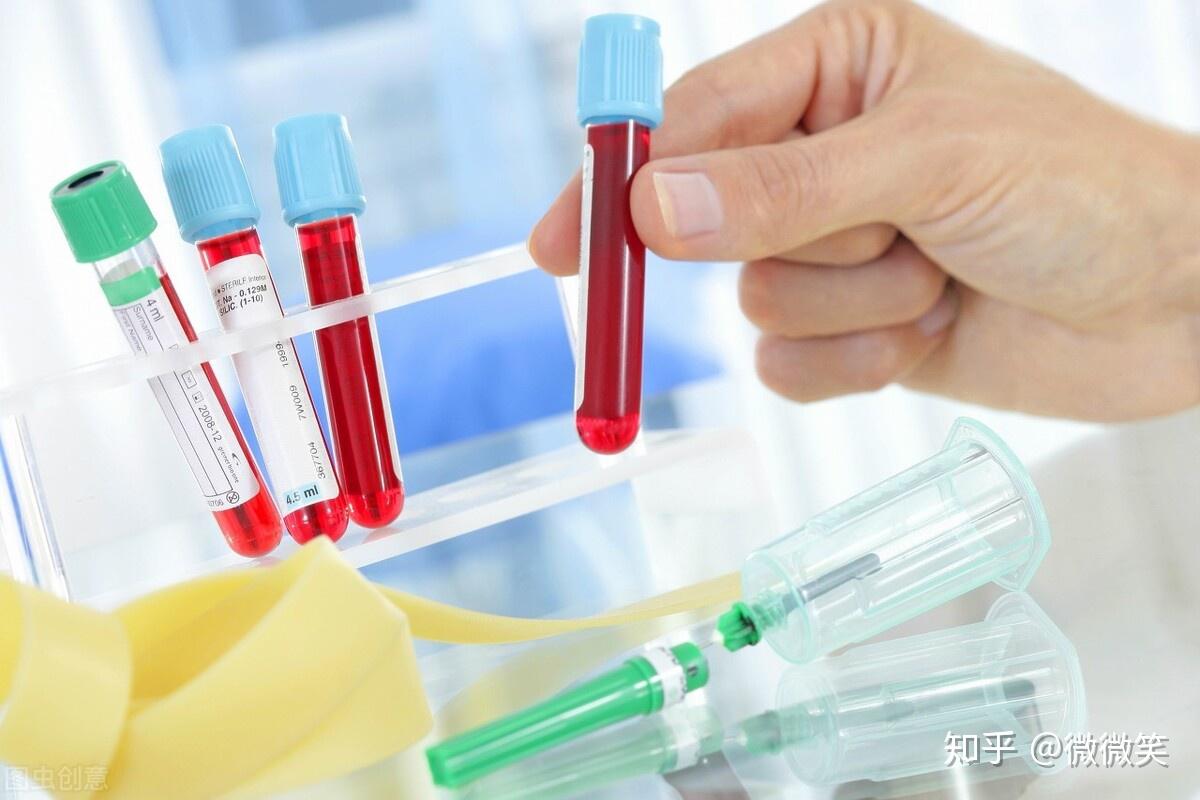 27个肾病要查的指标,一文让你成为半个肾病检验专家 - 知乎