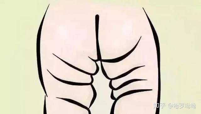 5个月宝宝这个是臀纹不对称吗