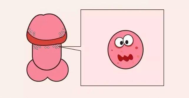 鸡儿上面长痘痘不痛不痒