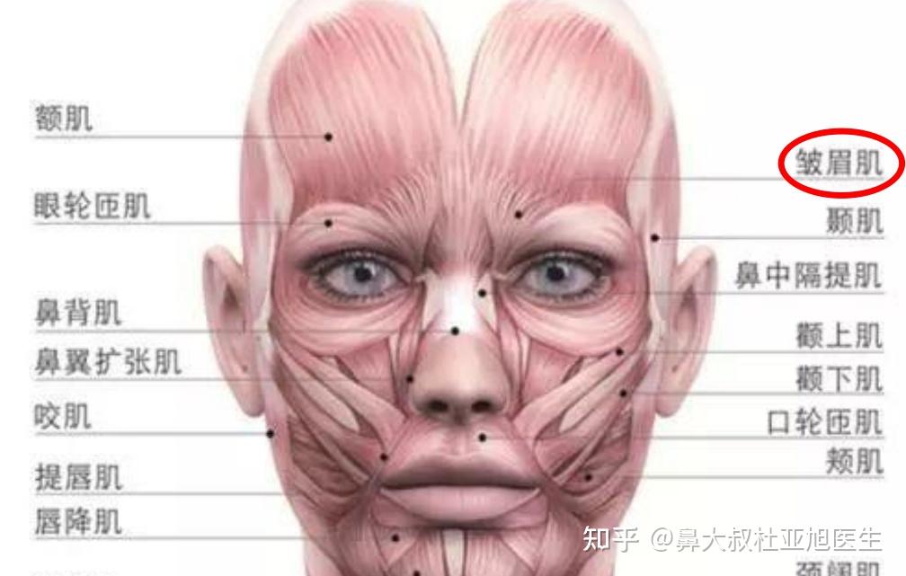 川字纹是怎么引起的？ - 知乎