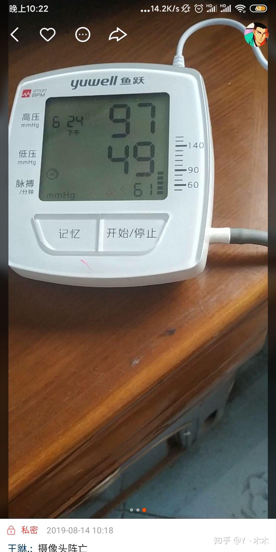 血压的低压在50左右意味着什么怎么解决