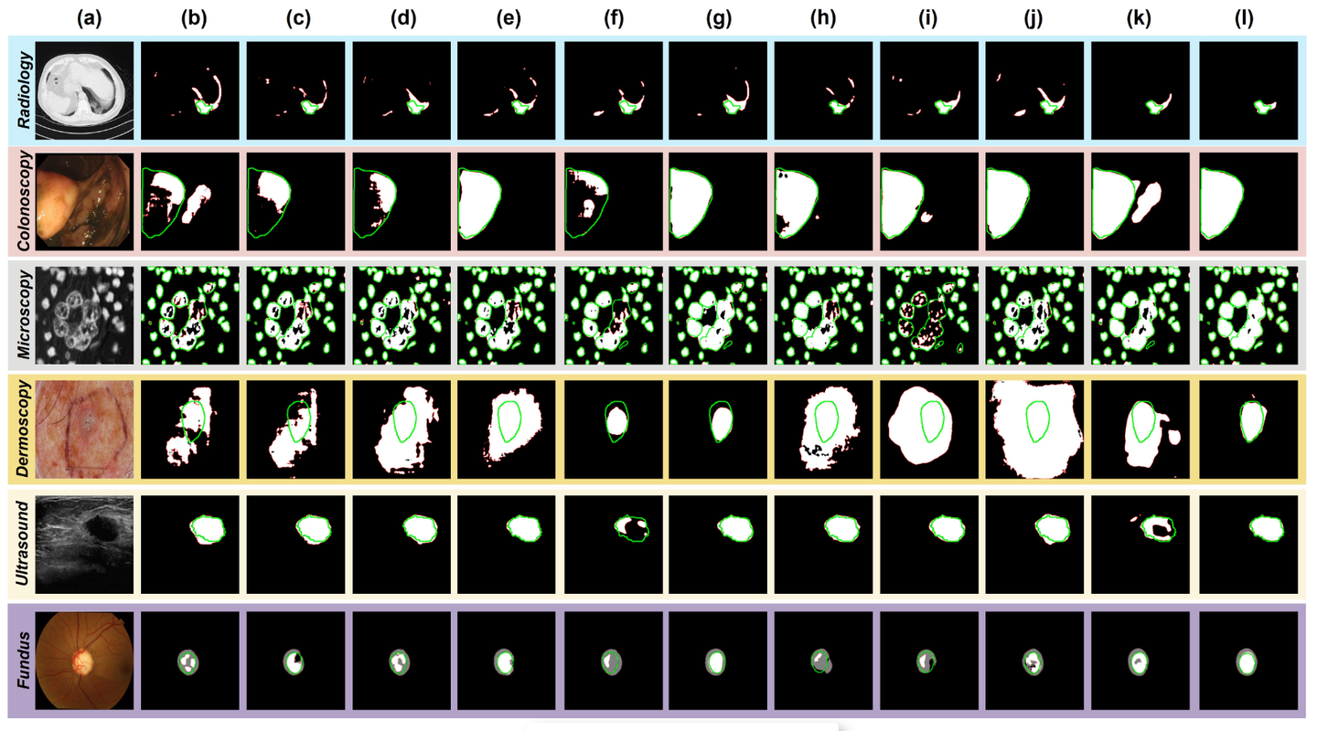 【CVPR2024】Generalizable Medical Image Segmentation by Multi-Frequency ...