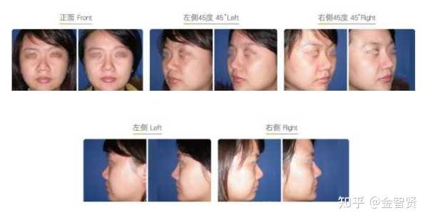  这次疫情治愈后有后遗症吗知乎文章(疫情治愈以后有后遗症严重吗)