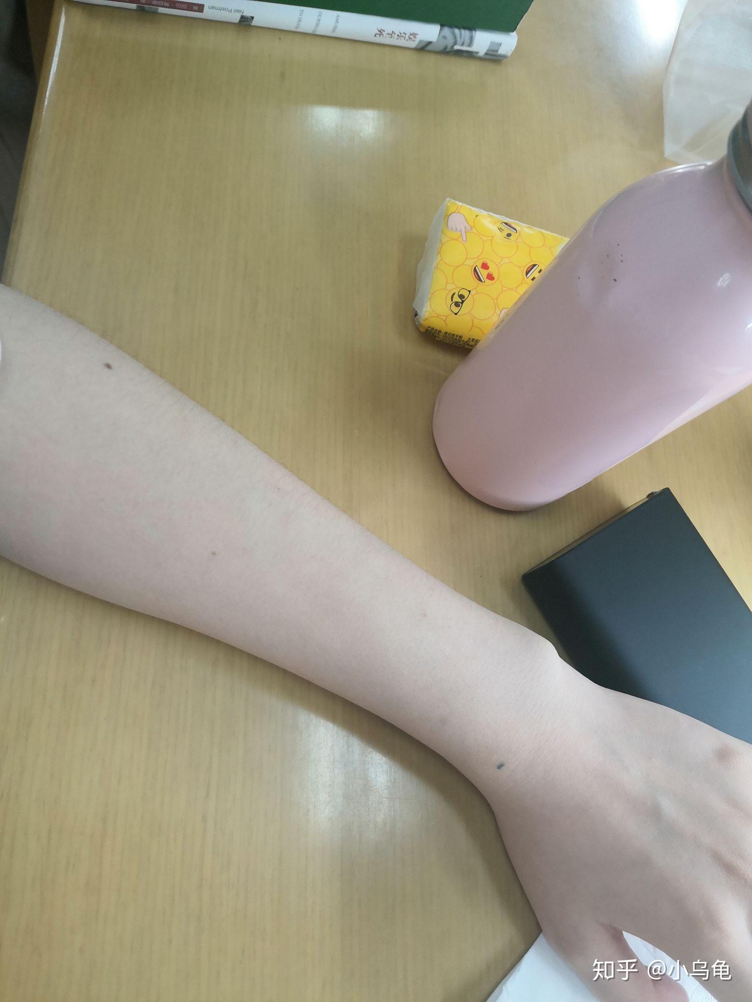 经常涂防晒霜脸手臂皮肤会不会变白