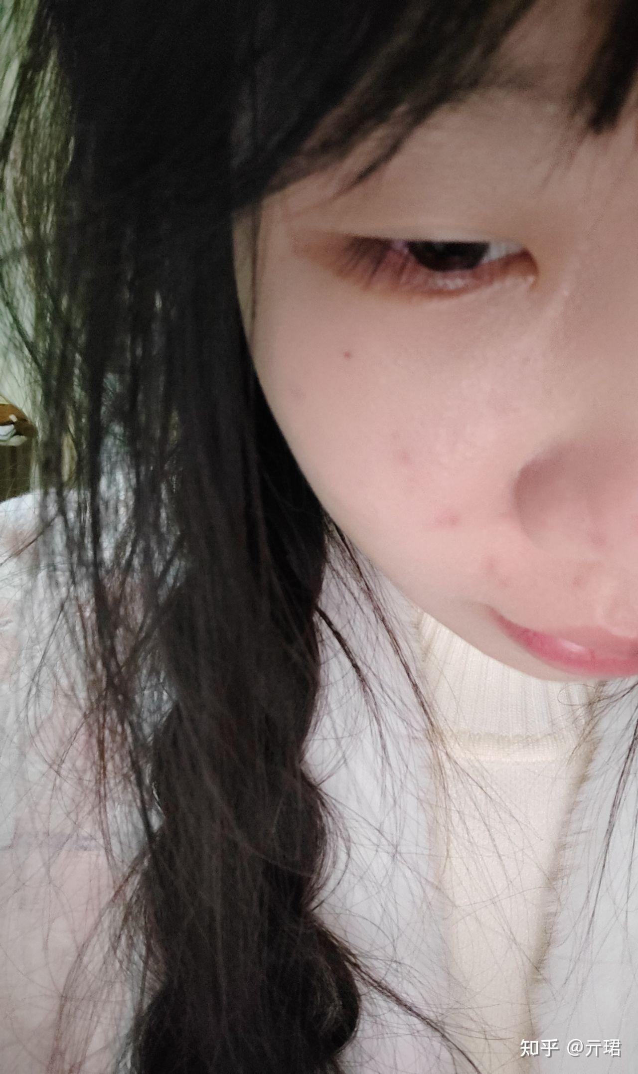 有眼尾沟的眼睛好看吗? - 知乎