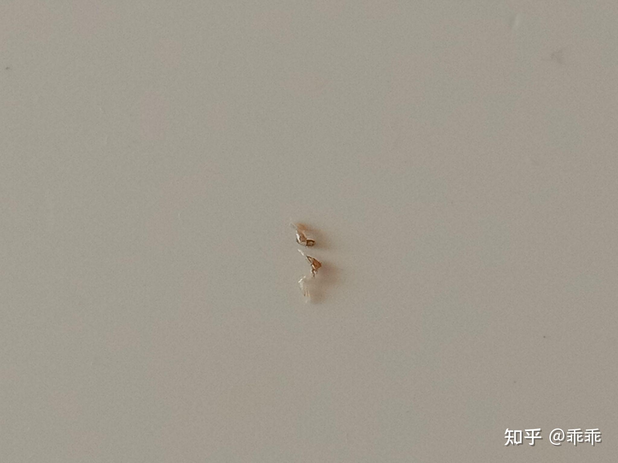 这个是不是虱子卵啊? - 知乎