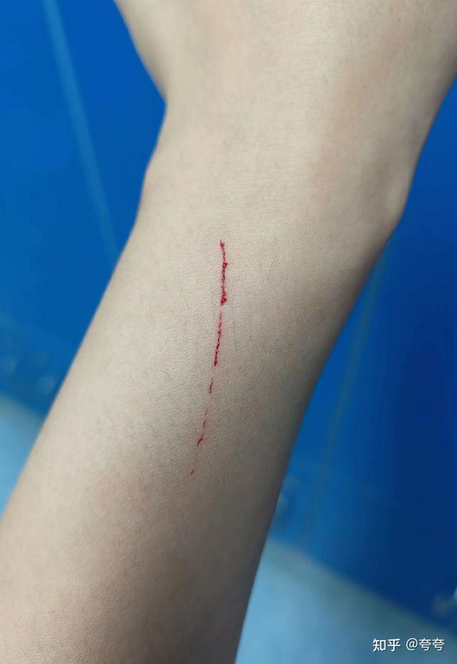 两天前我在洗澡时被一个没生锈的铁片划伤伤口不深需要打破伤风吗