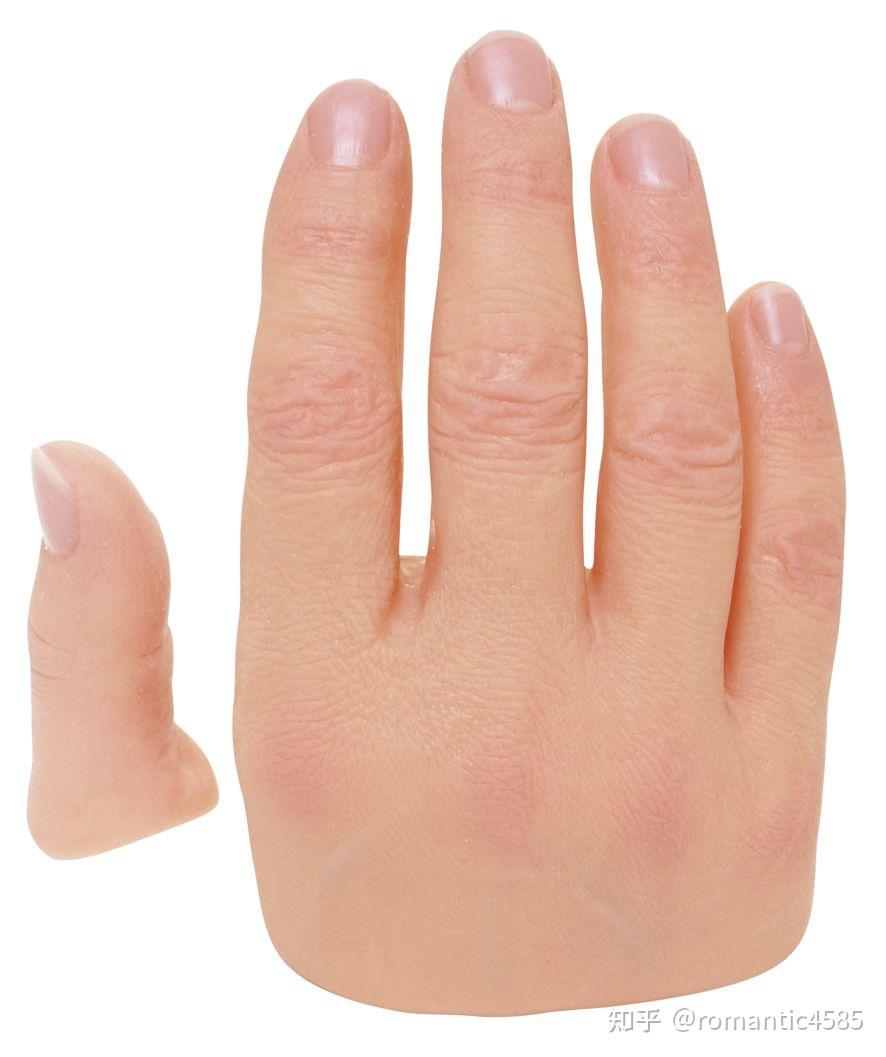 左手大拇指断了一截,这种情况会被认定为伤残几级?