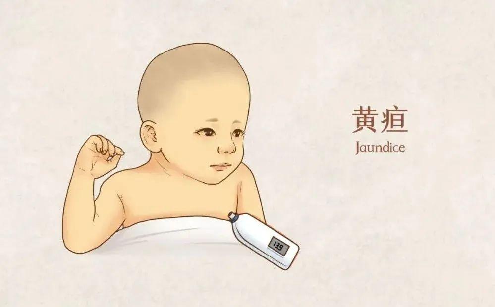 无需谈“黄”色变,正确认识新生儿黄疸 - 知乎
