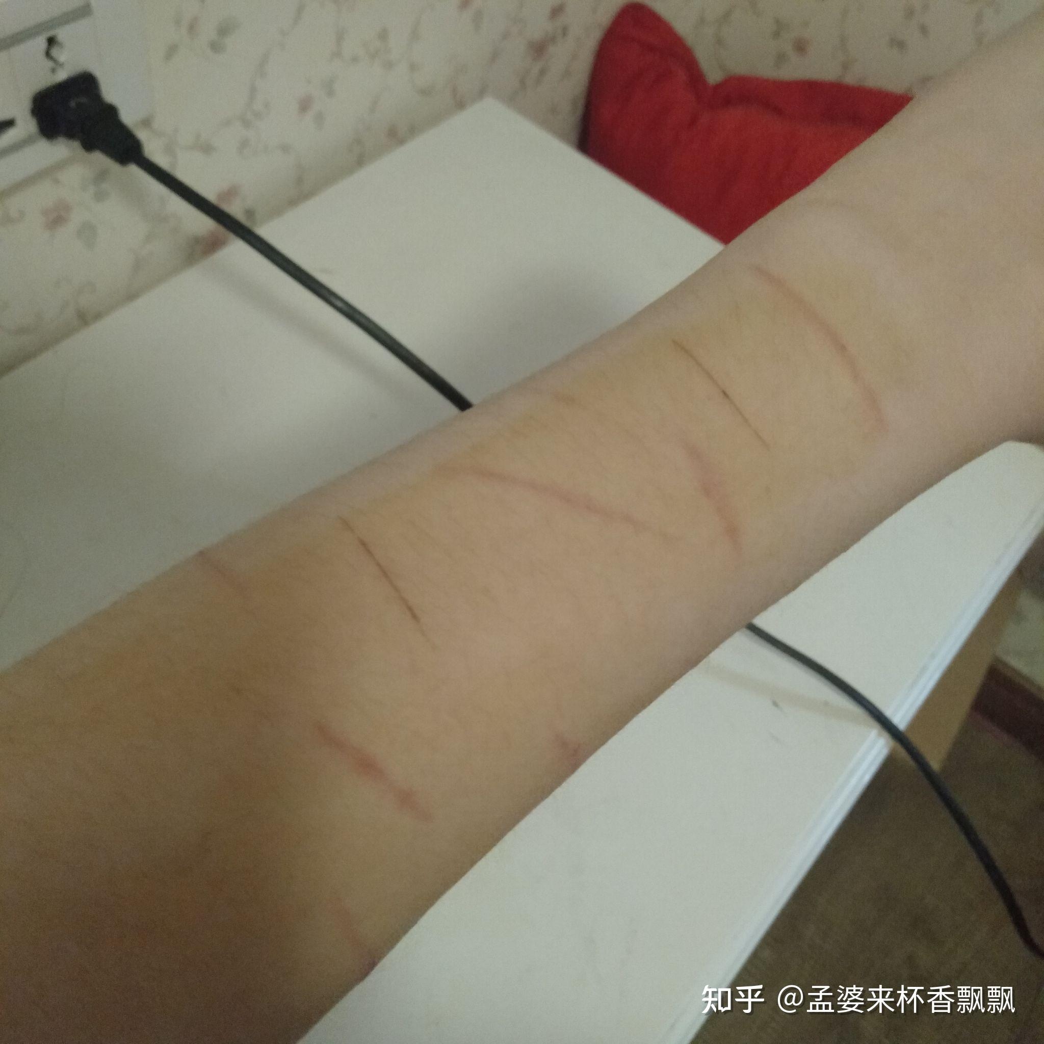 为什么当代中学生抑郁症好像很多