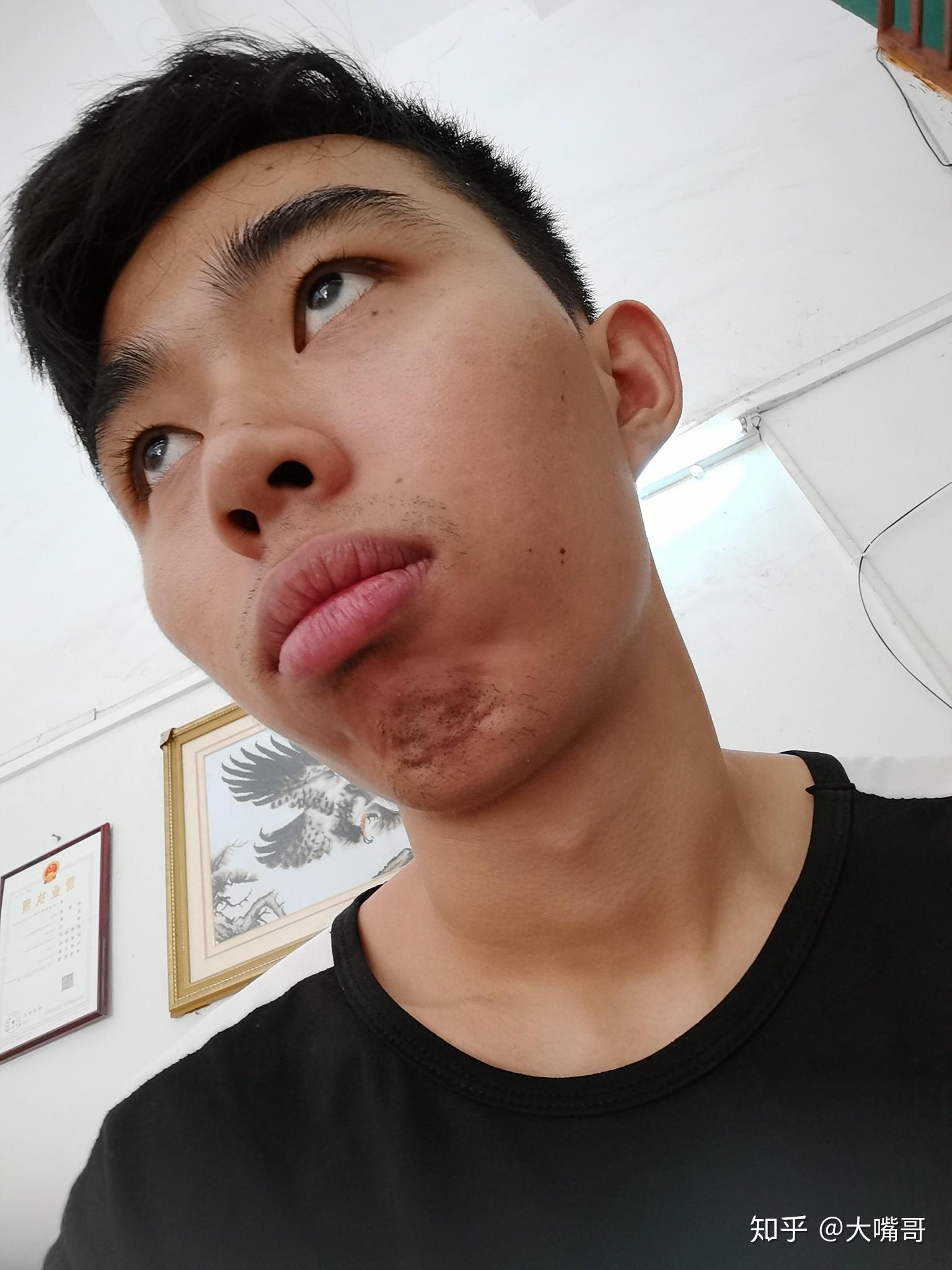 嘴唇厚超级厚超级丑? - 知乎