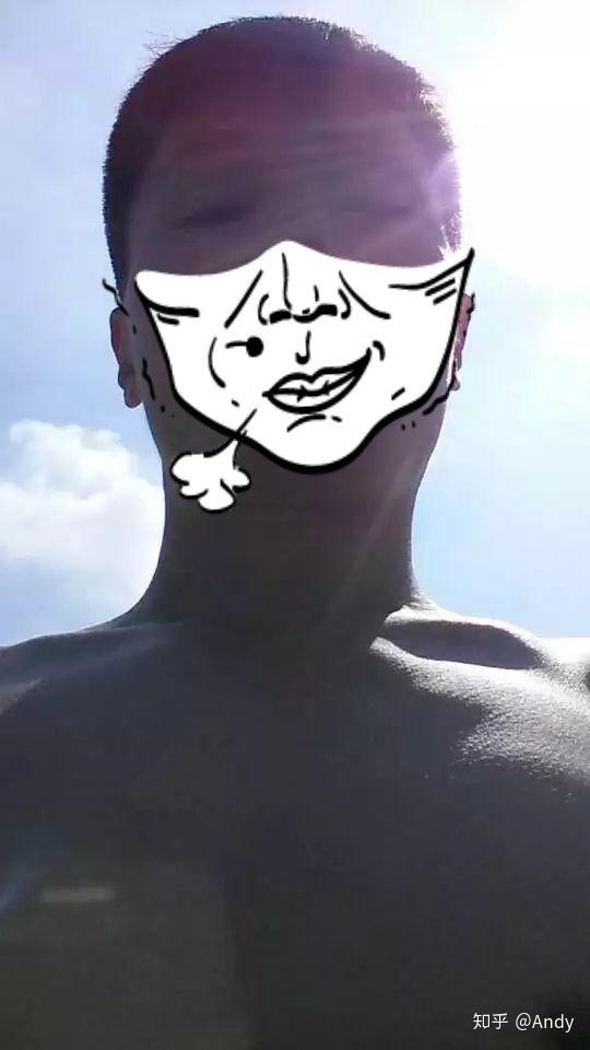 肩膀上突出的骨头是肩峰还是锁骨头