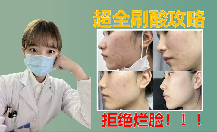 【史上最全刷酸攻略】刷酸真的有用吗?医学硕士手把手教你规范刷酸,解决黑头闭口、粗糙暗沉、毛孔粗大,刷酸新人速速上车!!! - 知乎