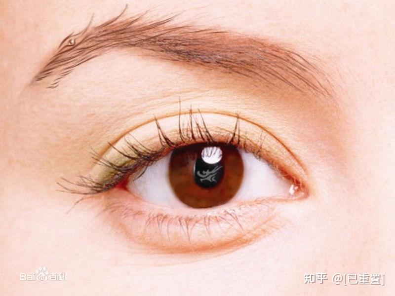 吸雕双眼皮是什么意思? - 知乎