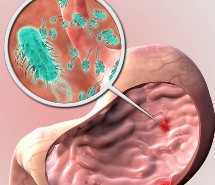 消化不良怎么办？这5个提高胃动力的方法做起来！！ 知乎