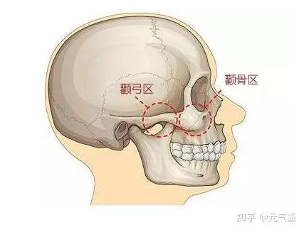 颧骨颧弓的位置图片