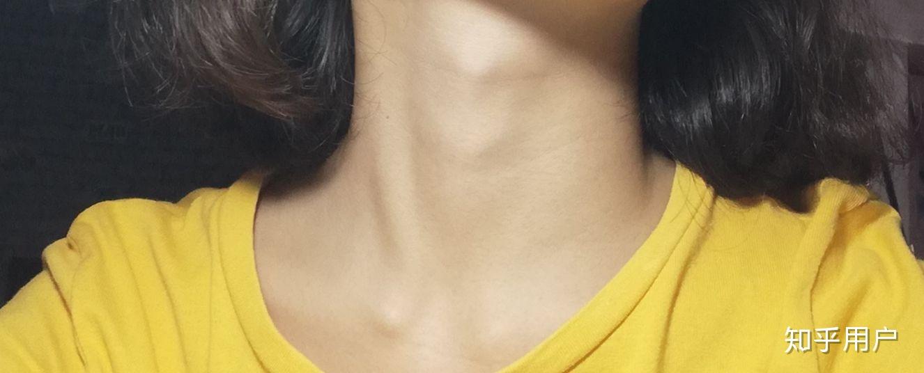 女性喉结位置图片