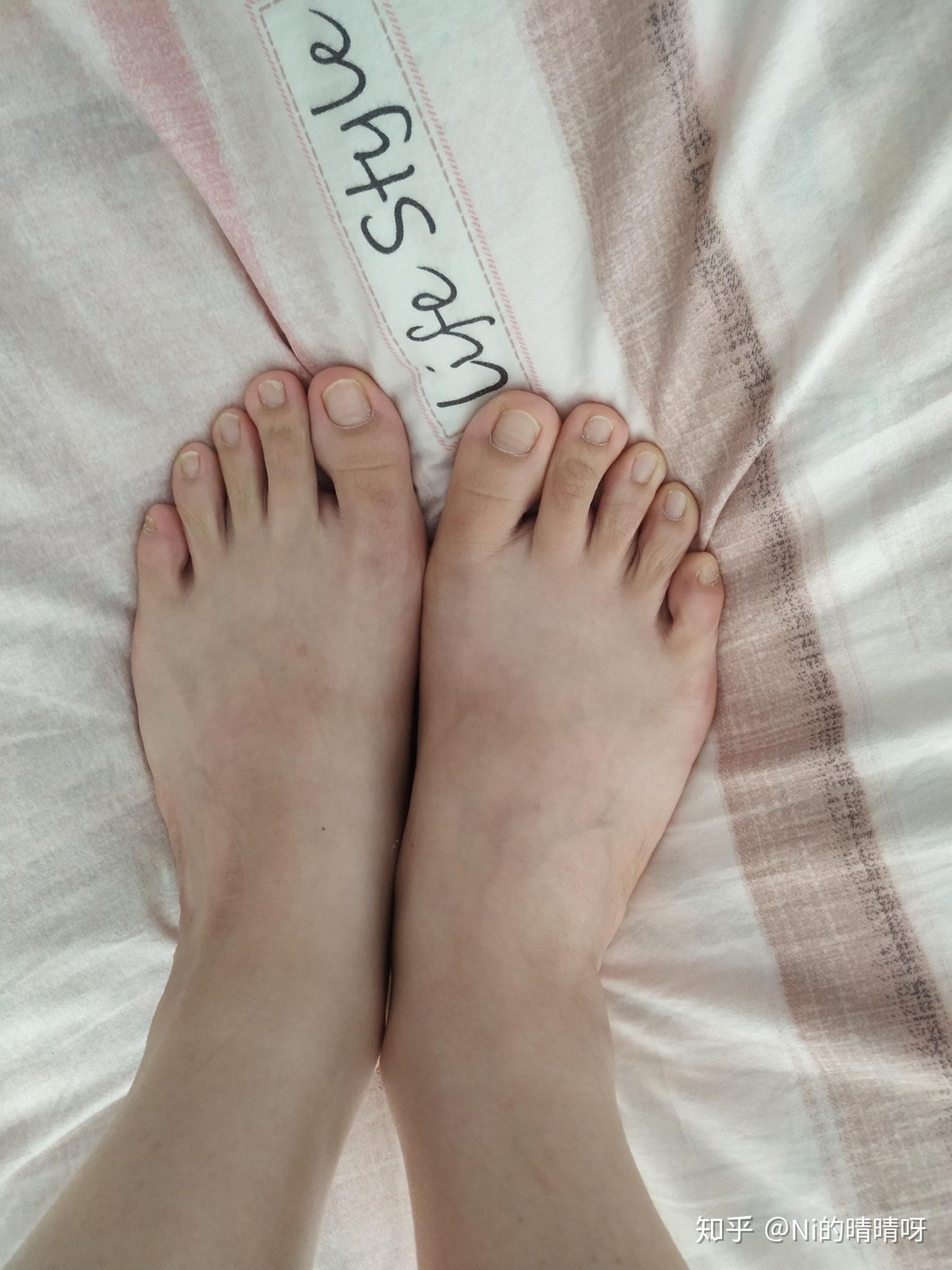 女生脚丑是种什么样的体验