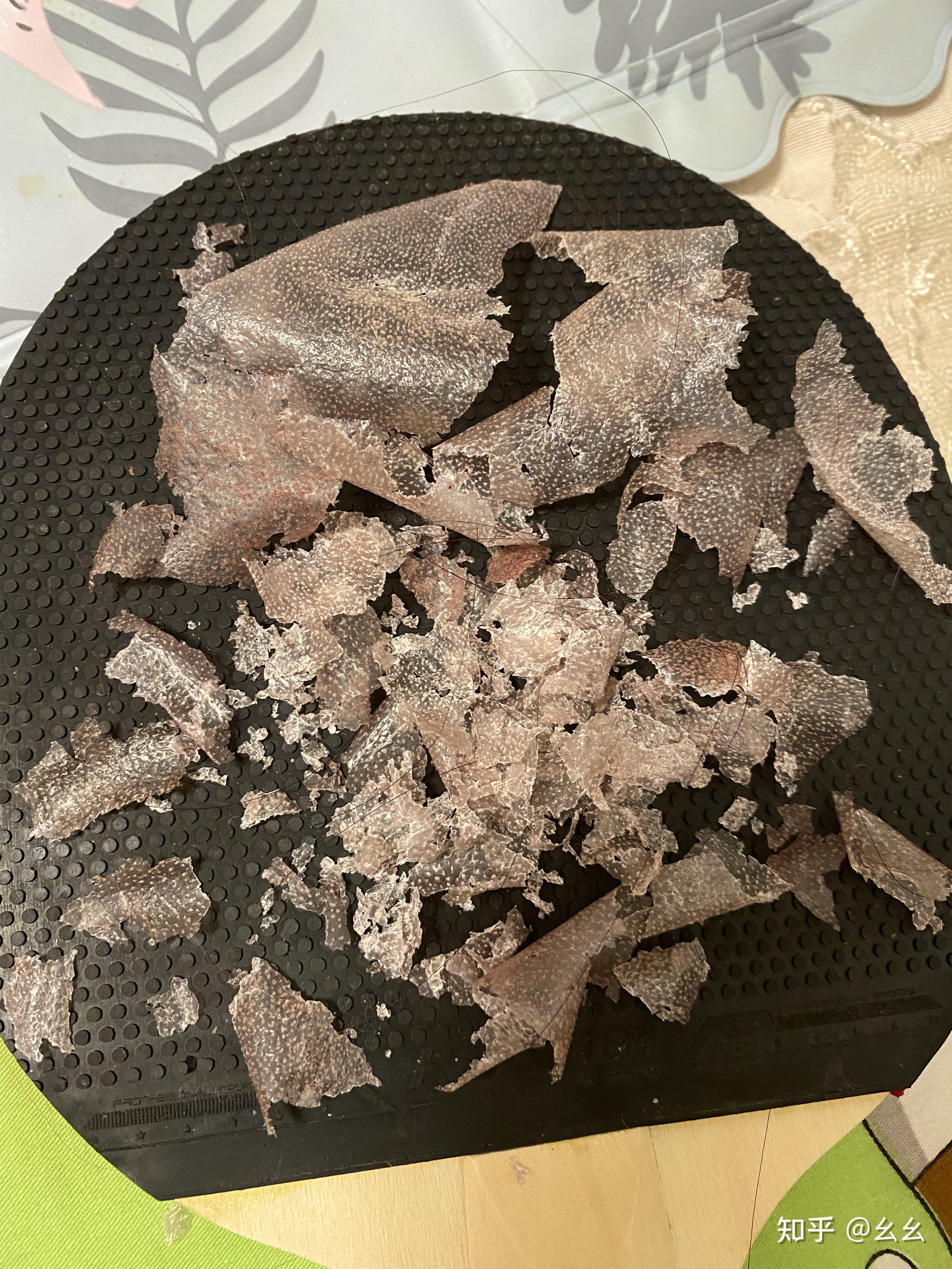 见过的最大头皮屑多大