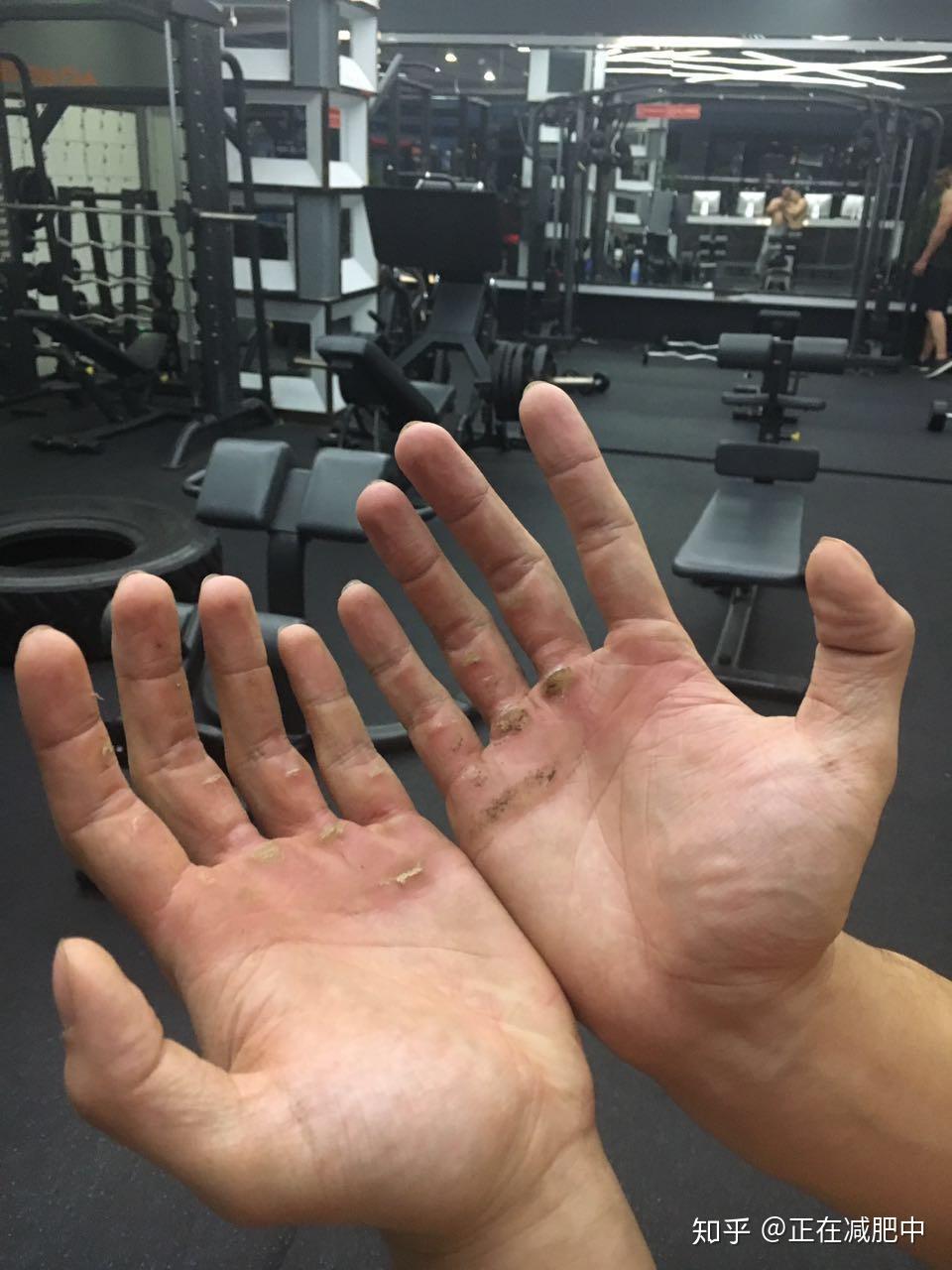 健身手破皮一般怎么处理? - 知乎