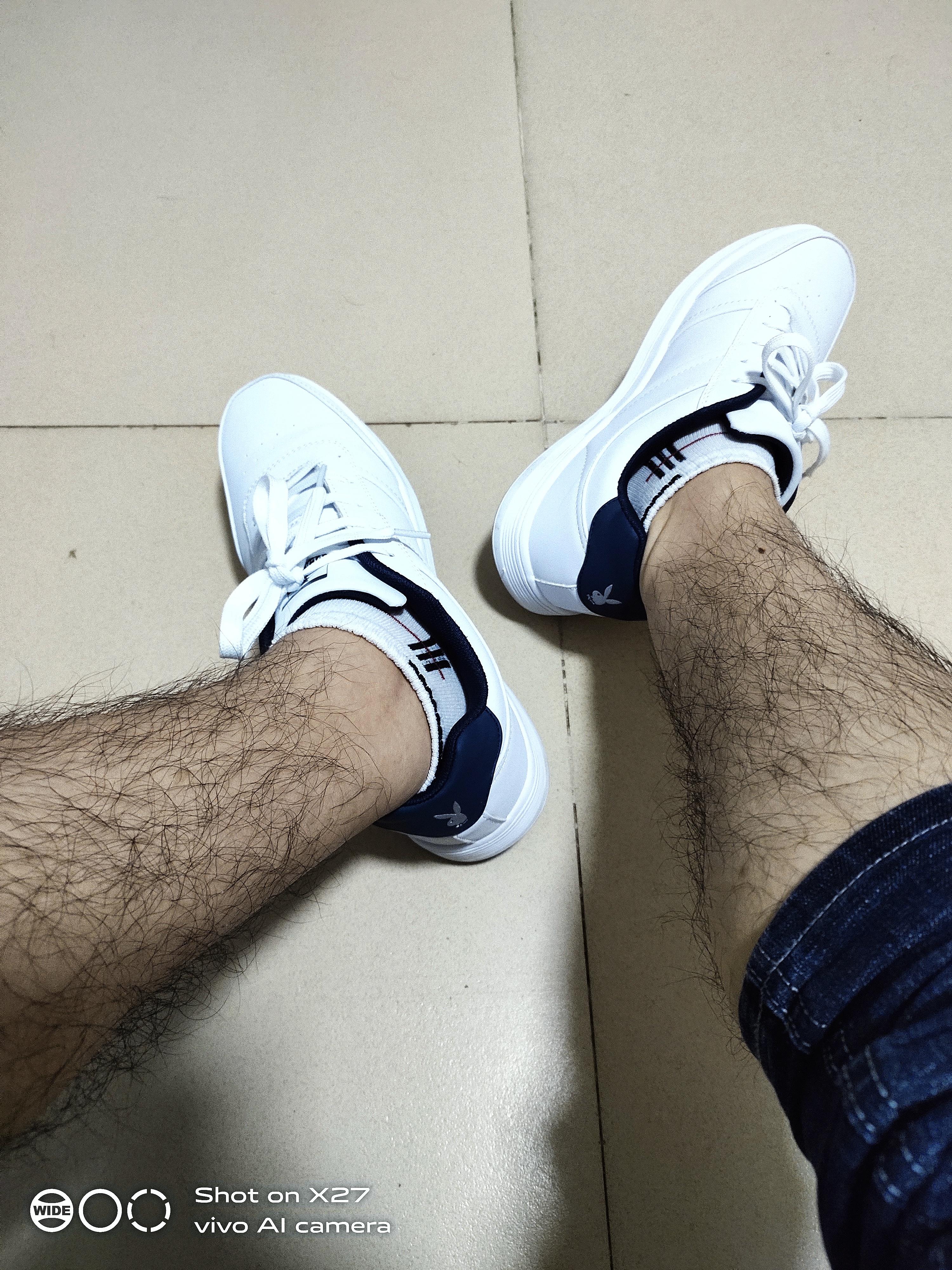 男生腿毛浓密怎么办
