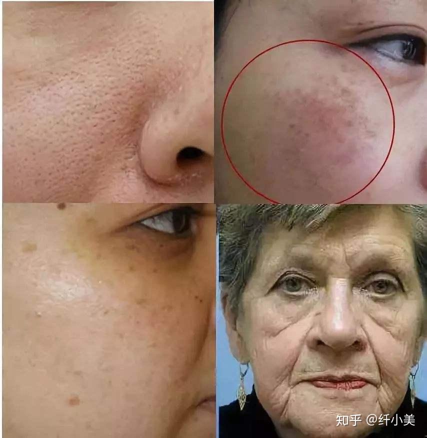 男生混合皮应该怎么护肤