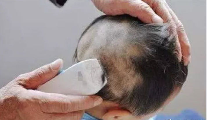 剃胎发,会让宝宝头发长得浓密吗? - 知乎