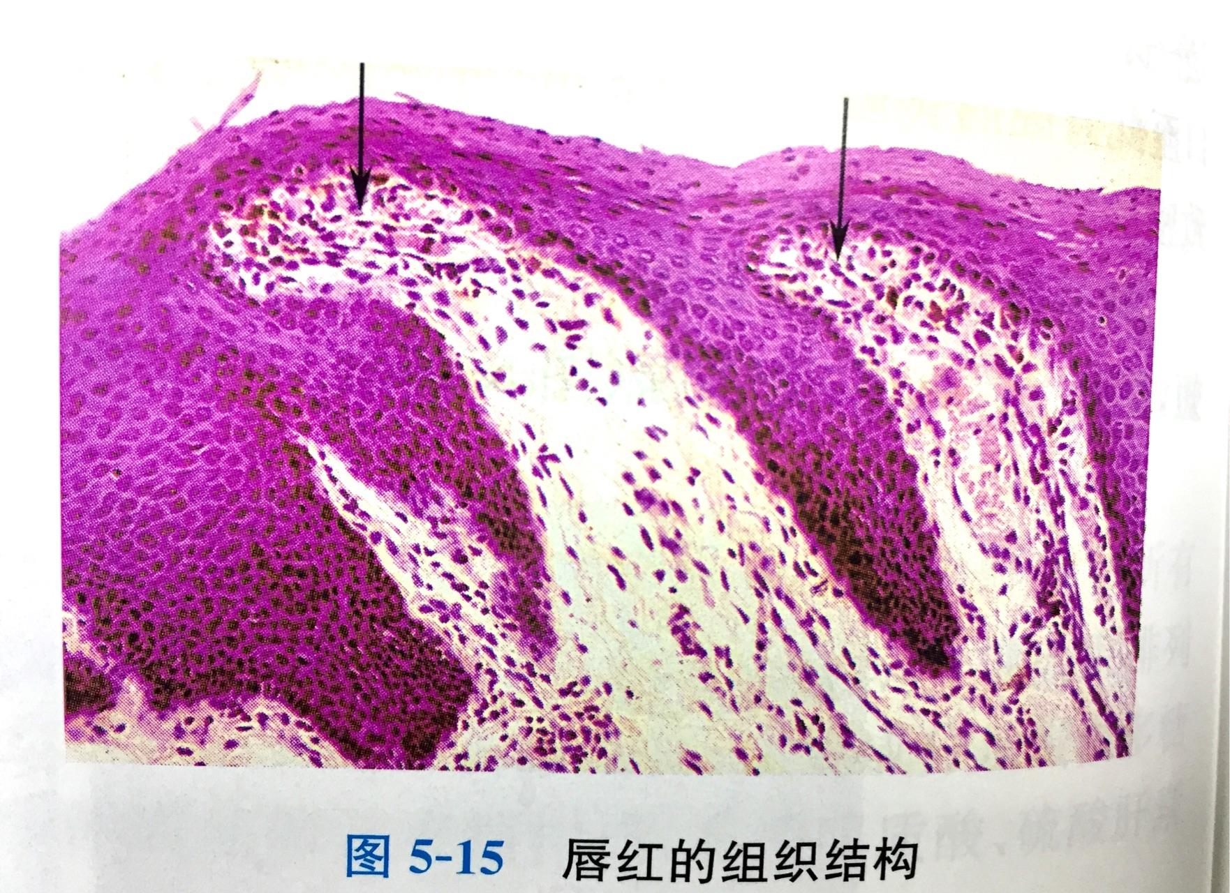 撕嘴唇会使嘴唇变厚吗