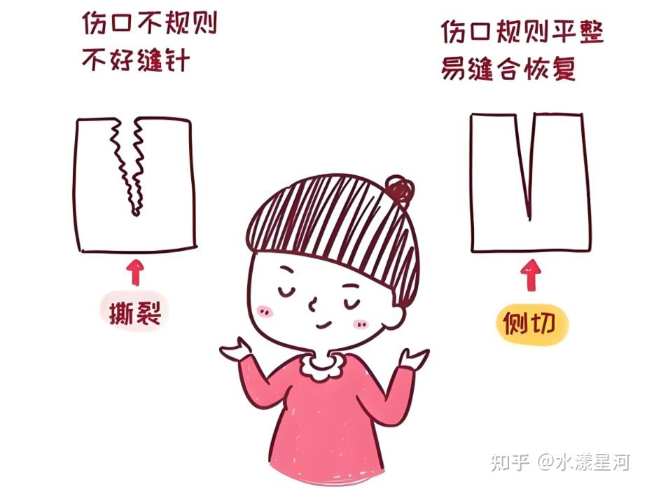 顺产也得挨一刀?如何减轻撕裂程度及降低侧切几率? - 知乎