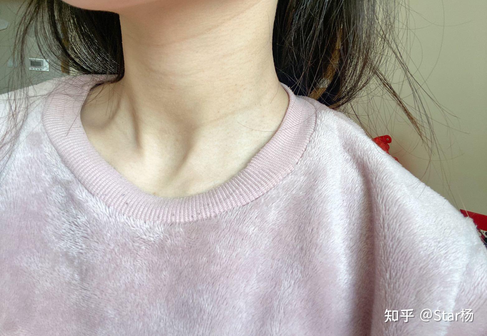 颈纹要怎样才能去掉?