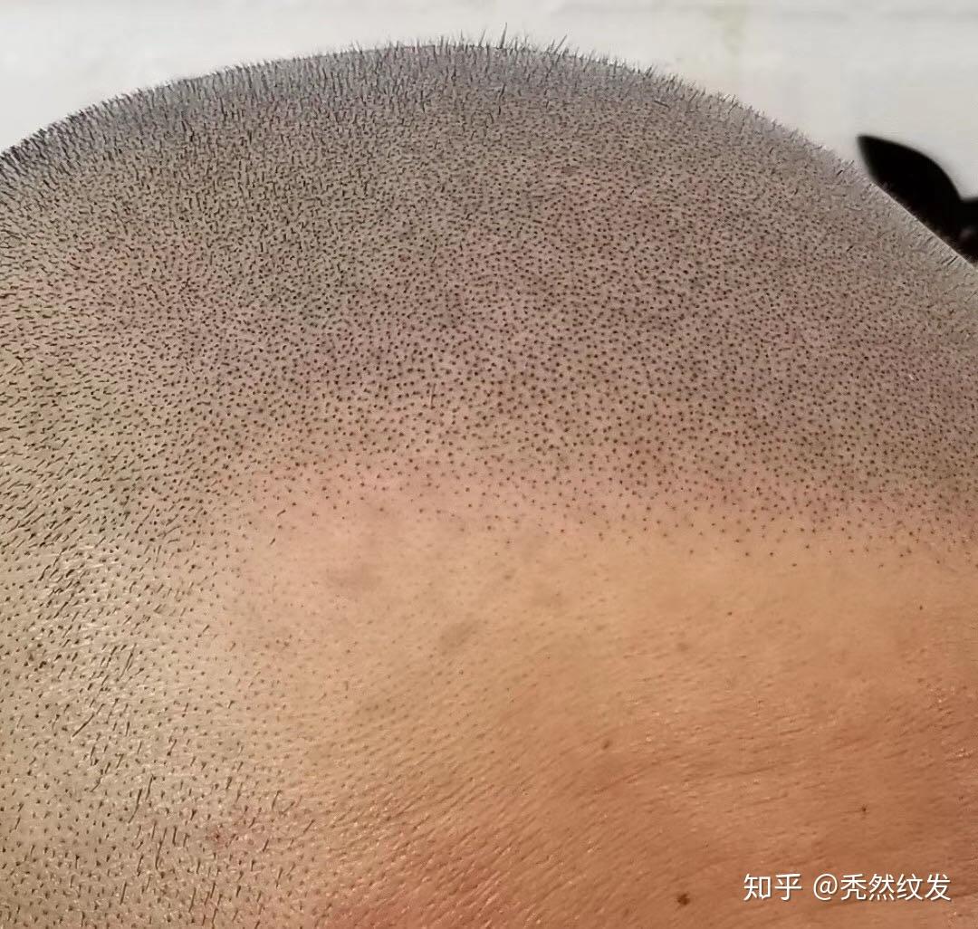 什么是纹发？ - 知乎