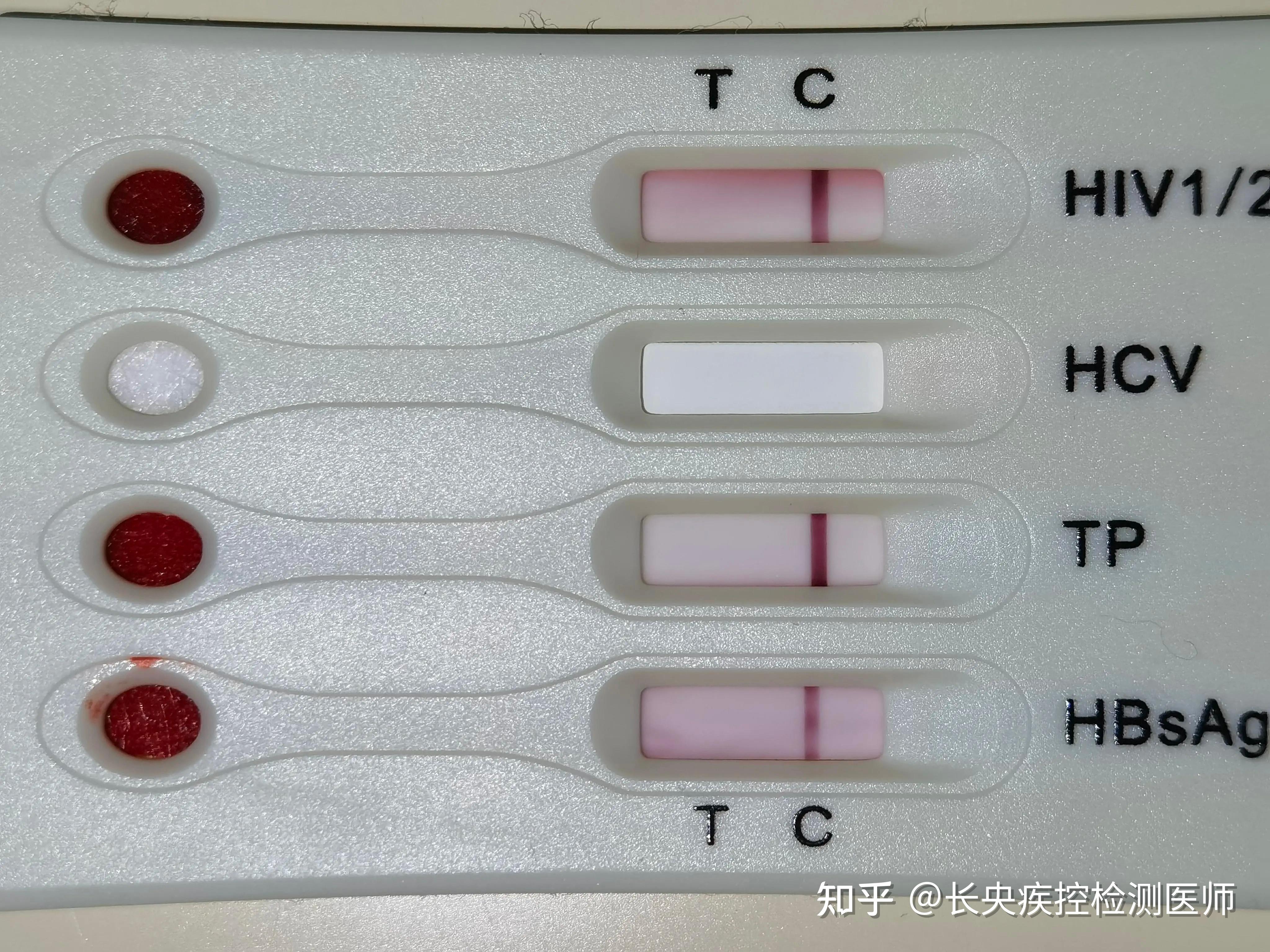 请问万孚四合一试纸测hiv准吗?