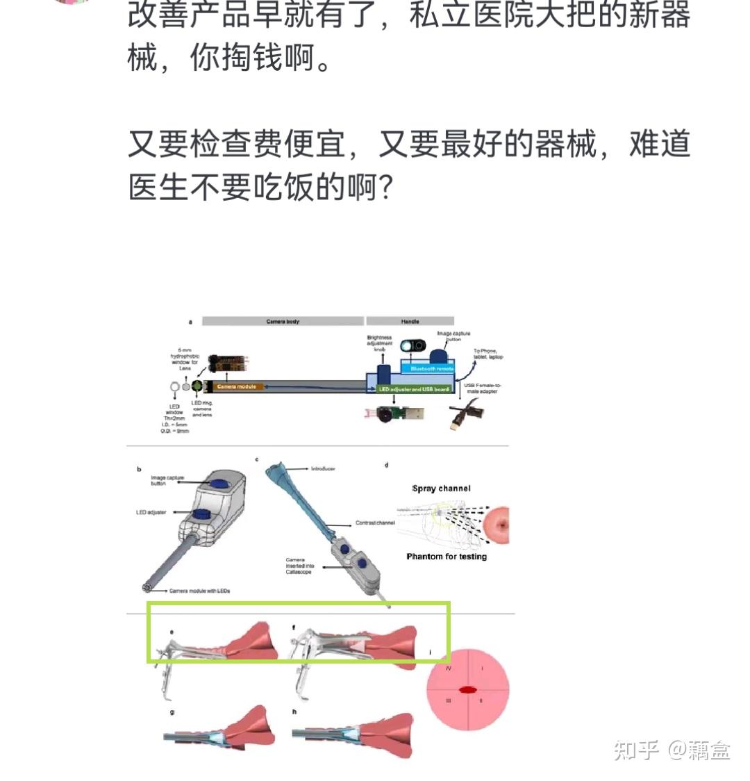 妇科鸭嘴钳子使用方法图片