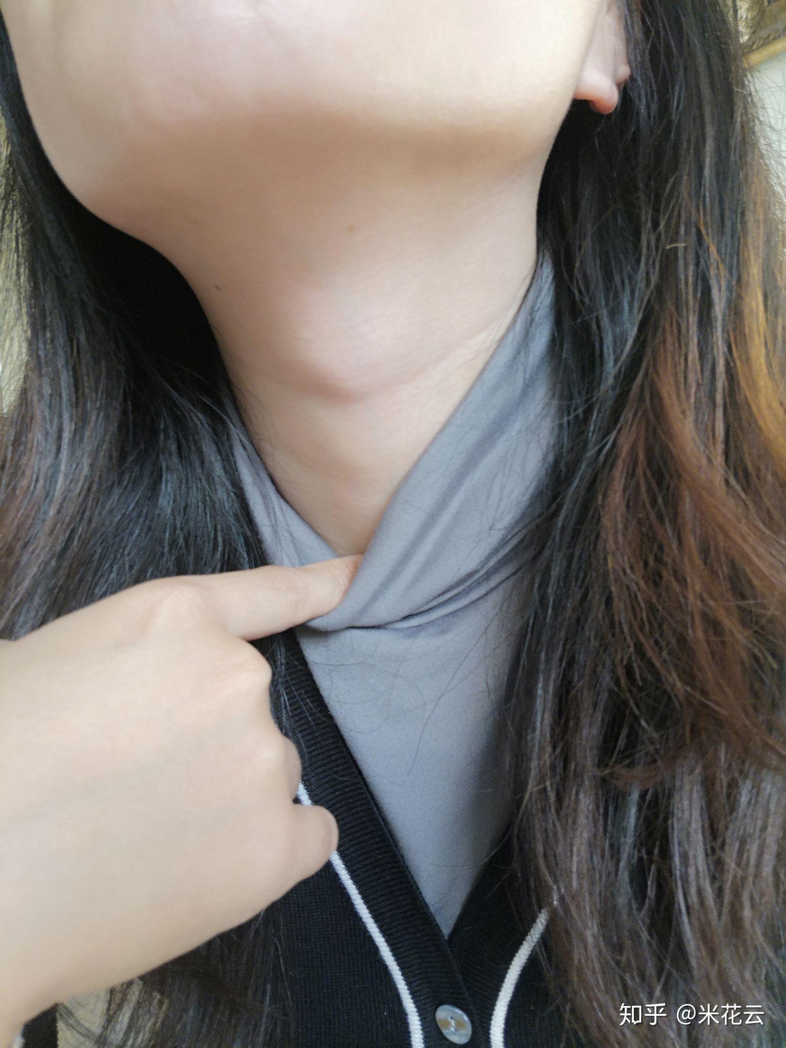 女性喉结位置图片