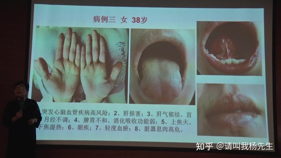 看的懂学的会,综合望诊(手诊+面诊+舌诊+目诊+耳诊) - 知乎