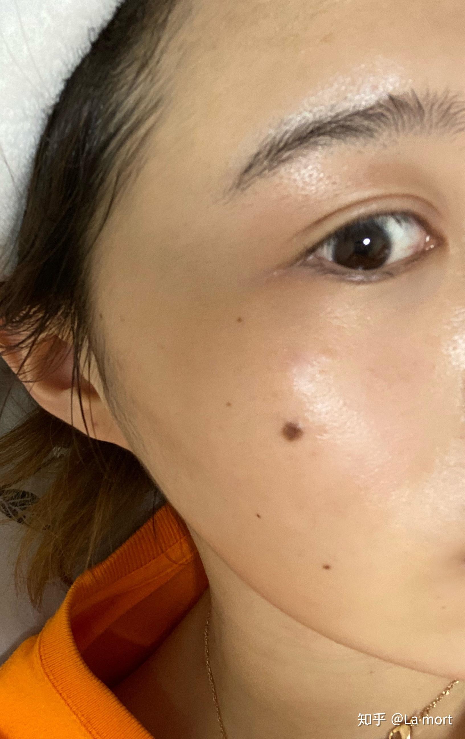 为什么有人说妖痣可怕妖痣究竟长在哪里