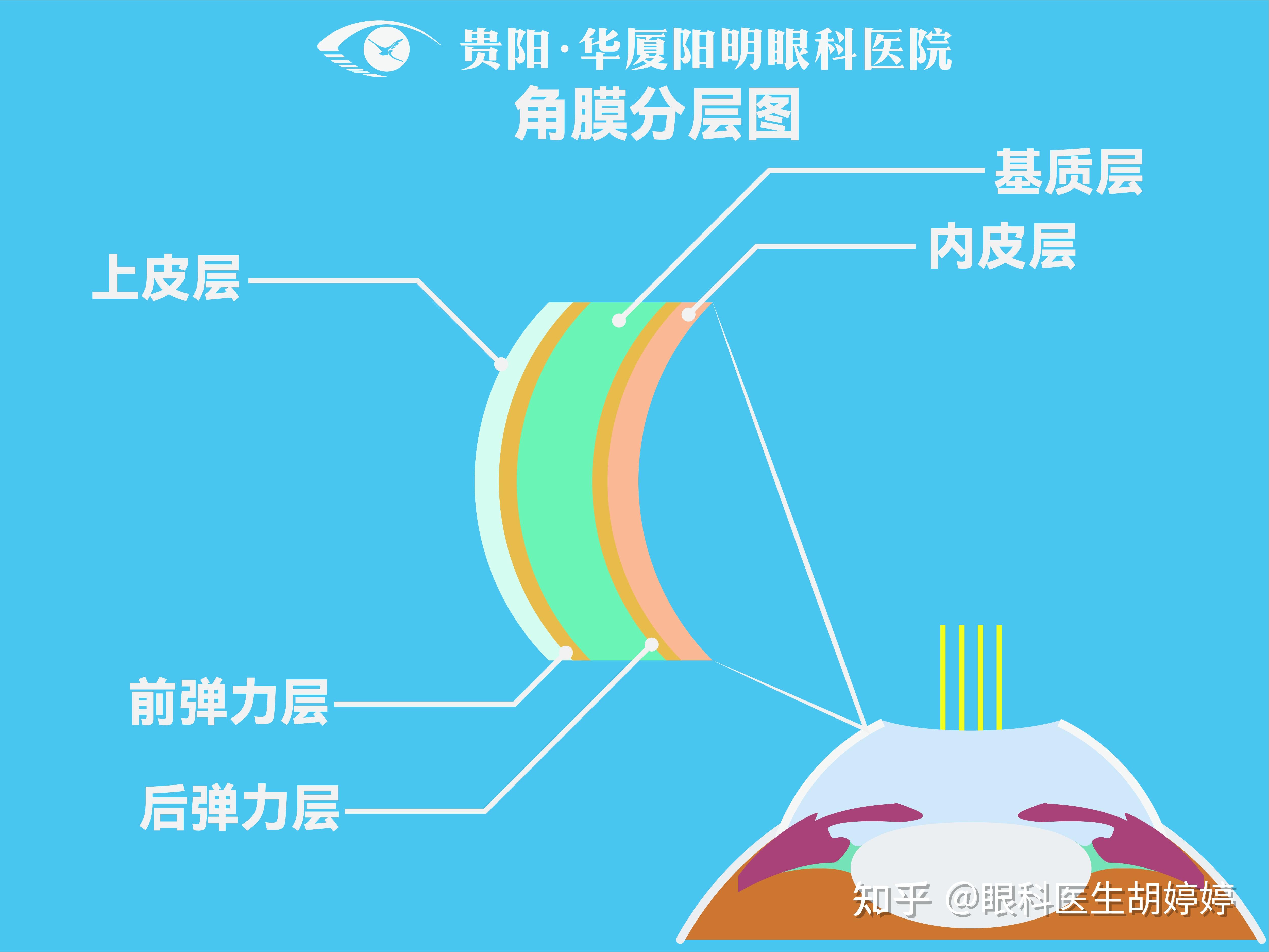 近视眼手术可以做2次吗?