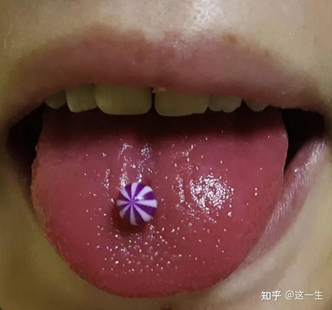 草莓舌不是食积化热,聊聊芒刺舌 - 知乎