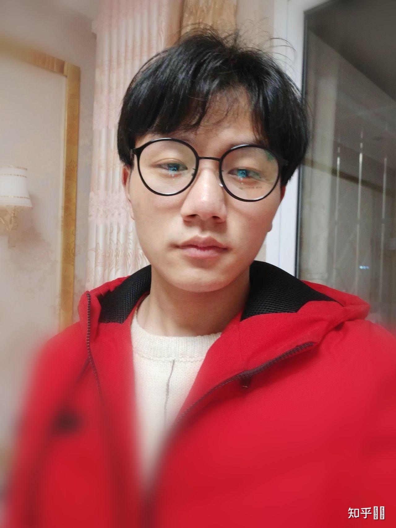 请问男生头发很细也很软,经常会贴在头皮上,有时候还会显得头发很少