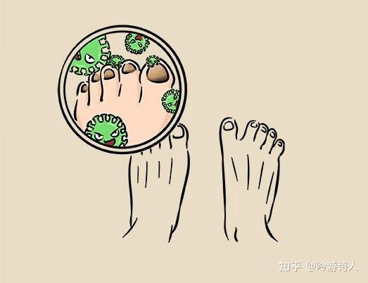 脚气完全有了抗药性怎么办?