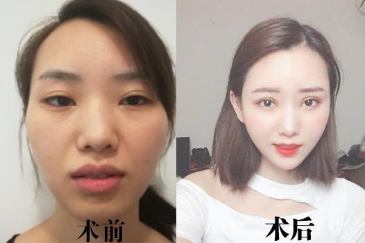 为什么现在的年轻女性会出现老态的现象 - 知乎