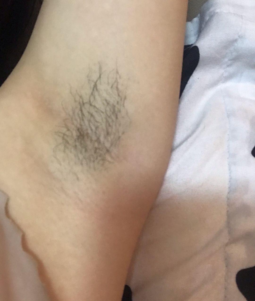 女生夏天怎么去腋毛? - 知乎