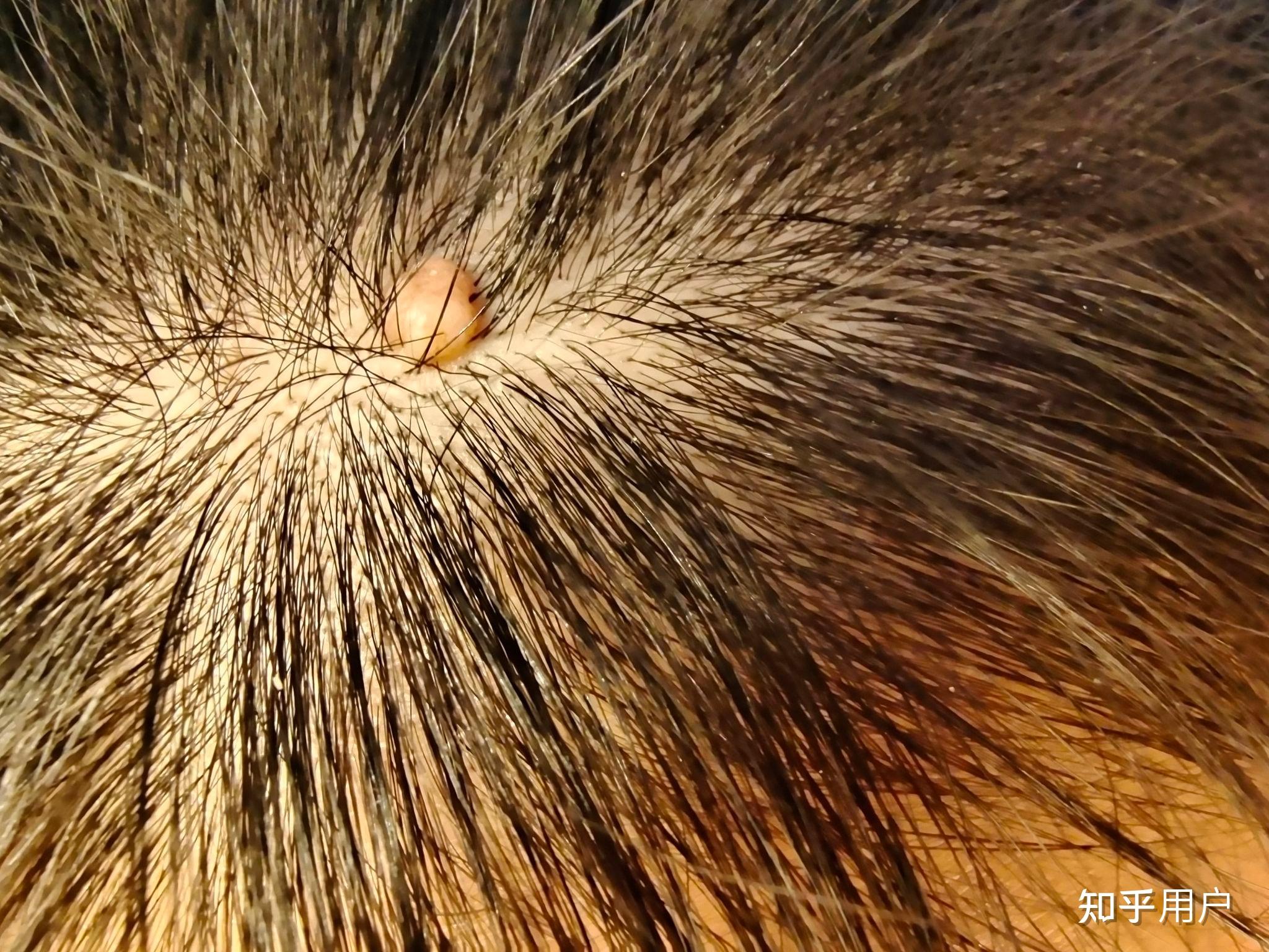 头发里面长痣对身体有害吗