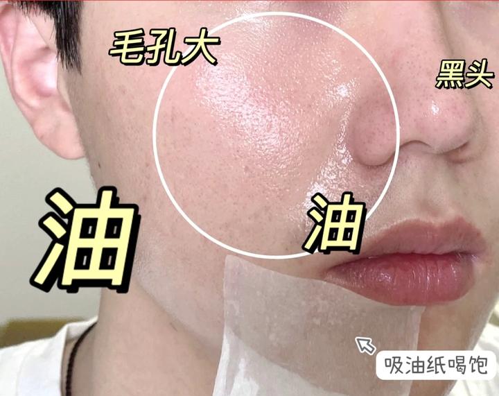 油皮怎么护肤?油皮该用哪些护肤品牌?油皮护肤品该怎么选?油皮洗面奶+控油水乳+祛痘凝胶推荐 - 知乎