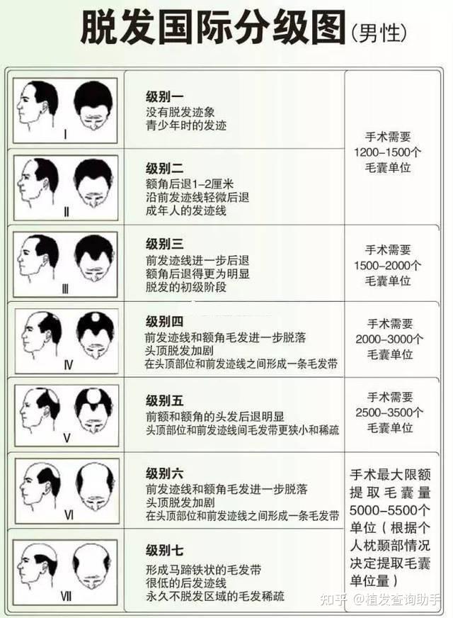 大连大连植发(大连植发哪里好)