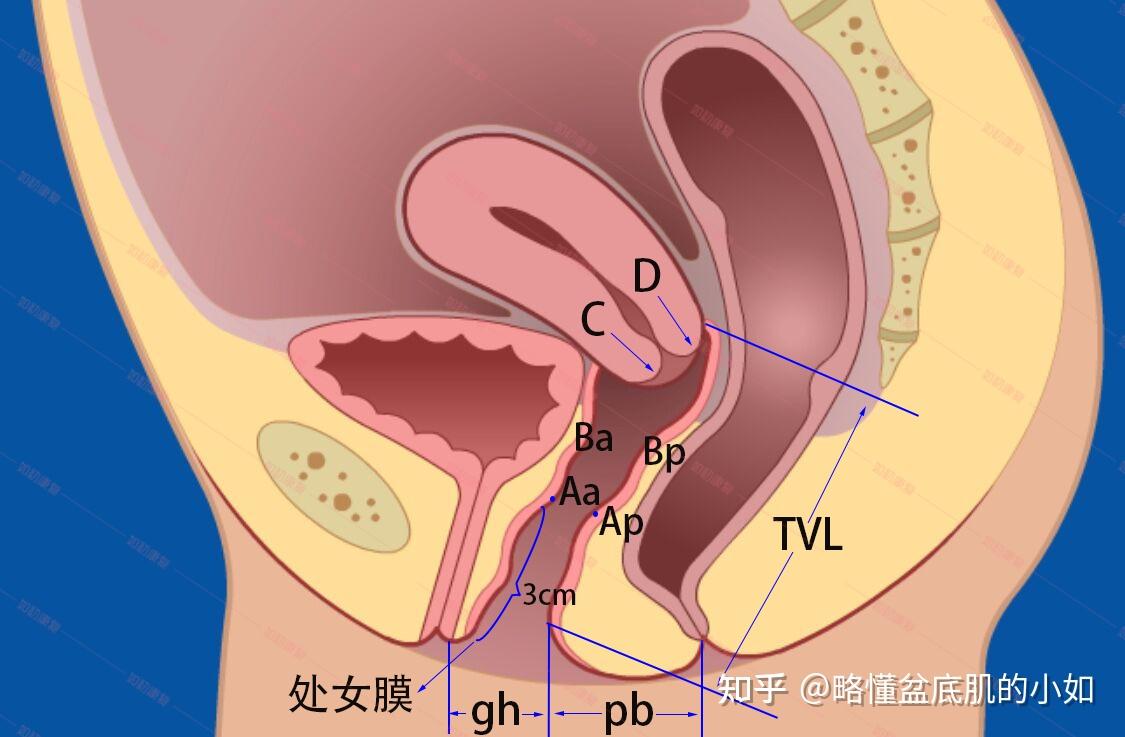 POP-Q评分图片